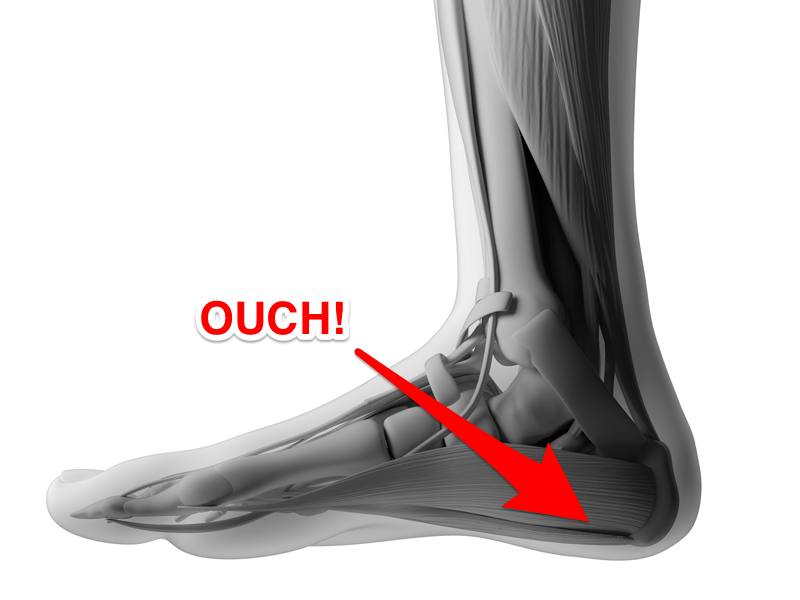 Pain in Heel? Are Insoles the Answer?