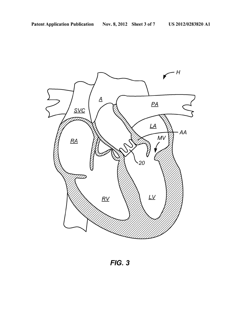 Unlabelled Diagram Of The Heart - Cliparts.co