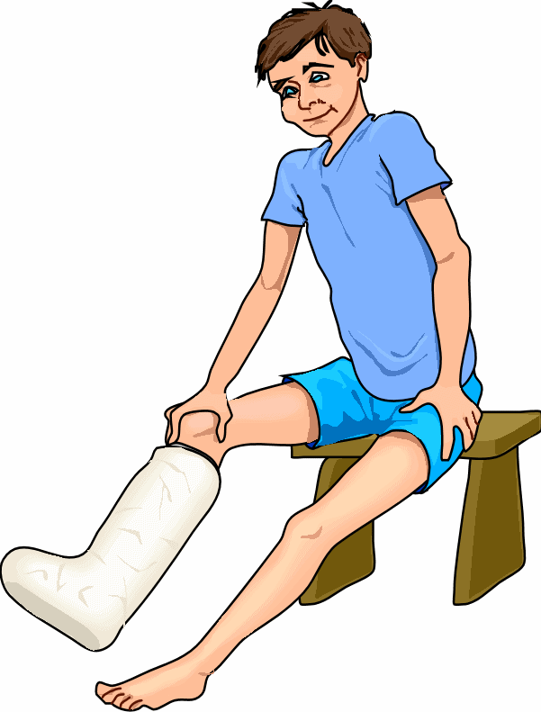 Broken Leg Cartoon - ClipArt Best - ClipArt Best