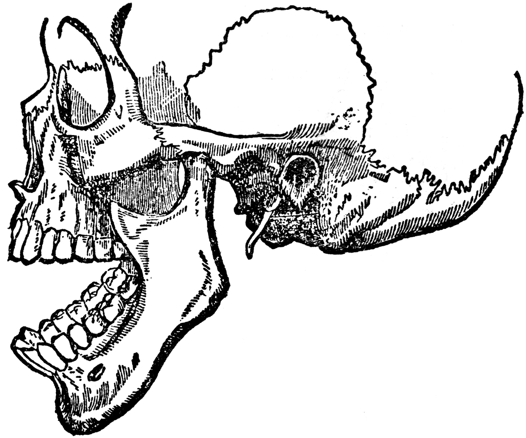 Dislocation of the Lower Jaw | ClipArt ETC