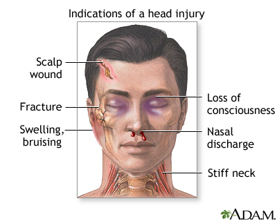 Head injury - first aid: MedlinePlus Medical Encyclopedia