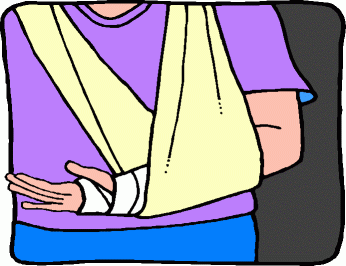 Broken Arm Clip Art - Cliparts.co