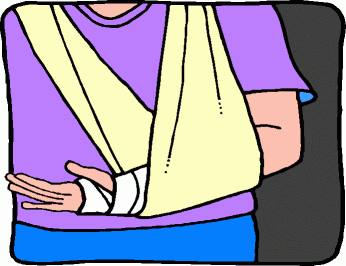 Broken Arm Clipart - Cliparts.co