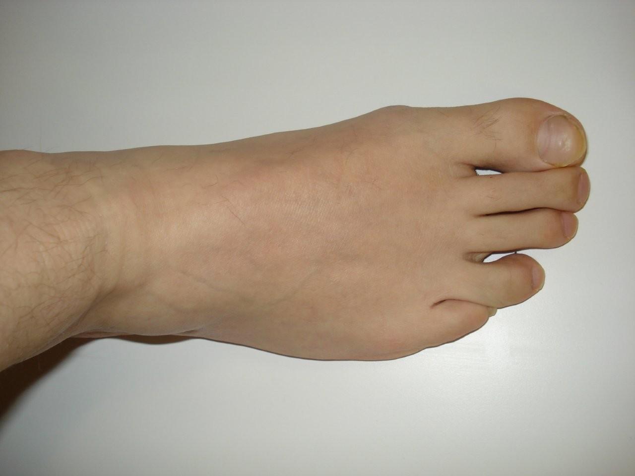 File:Right foot.jpg - Wikimedia Commons