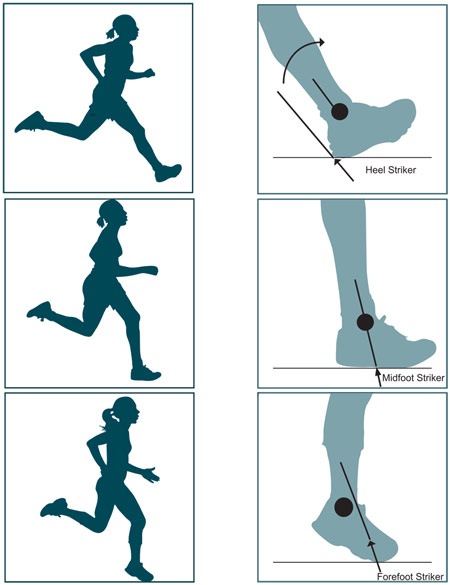 Effects of minimalist shoes on running gait | Lower Extremity ...