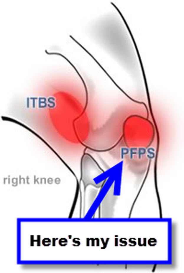 The Dreaded Runner's Knee | Races, Reps, and Ramblings