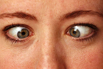 What if I crossed my eyes for 10 minutes? - HowStuffWorks