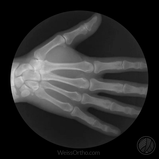 Animated X-rays reveal how your bones move | Animation | Creative Bloq