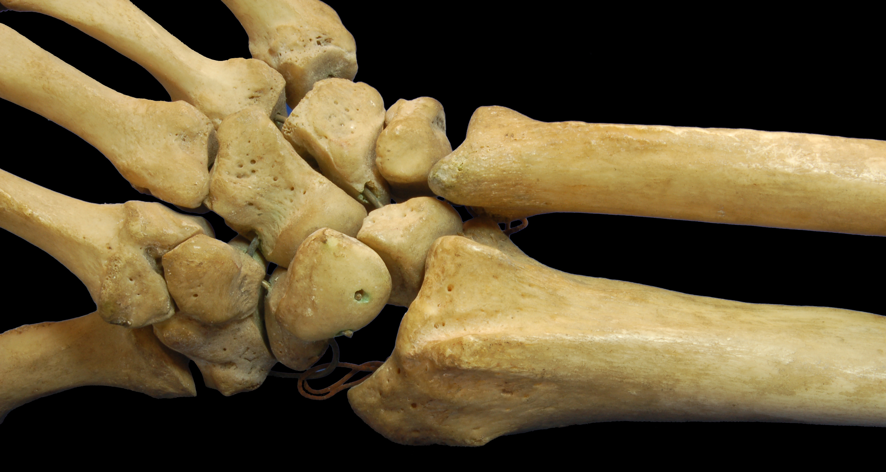 Short bone - Wikipedia, the free encyclopedia