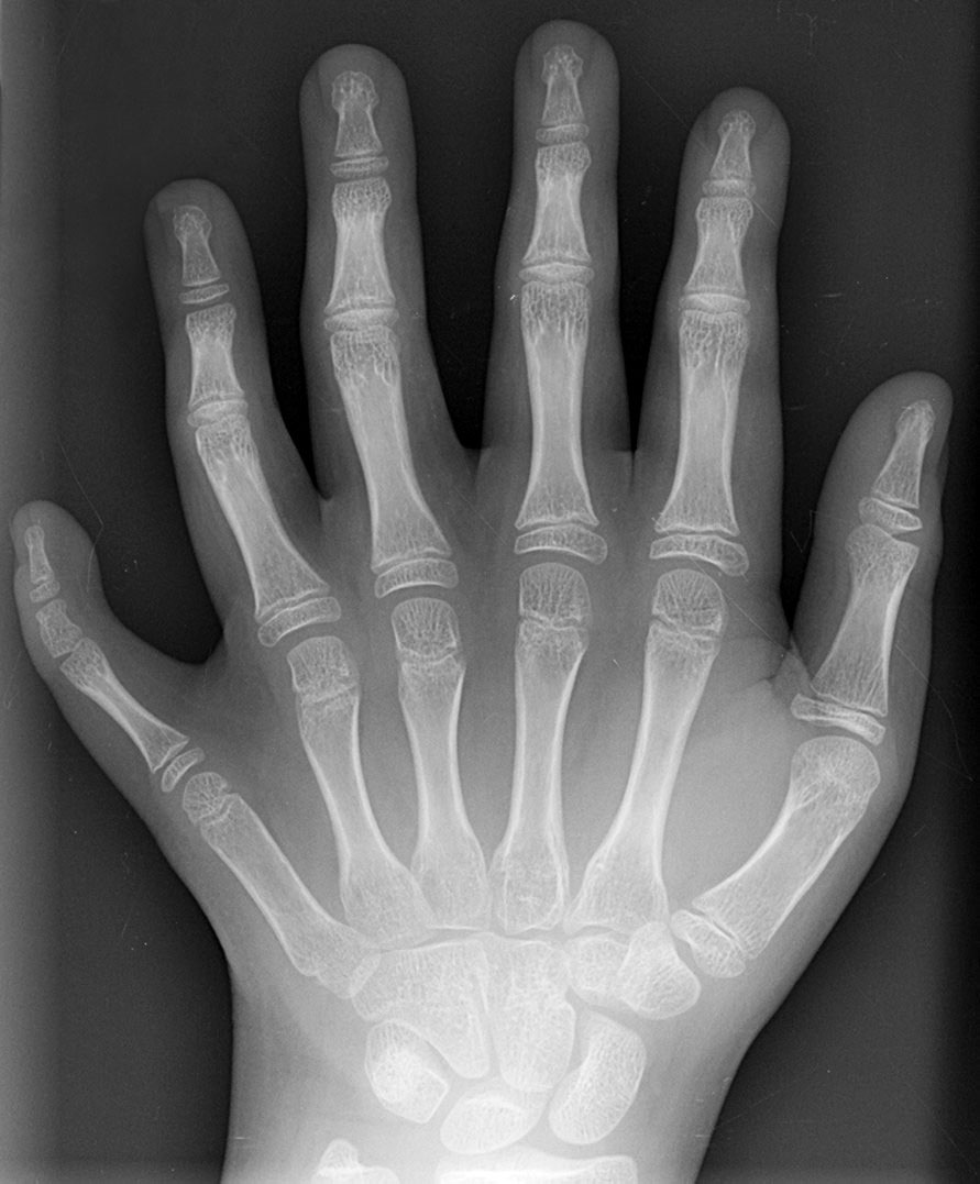 Hand - Wikipedia, the free encyclopedia