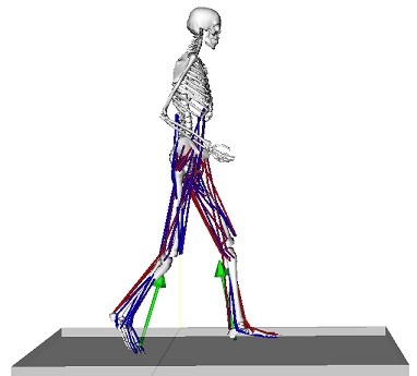 Hip joint load calculation after total hip replacement (THP ...