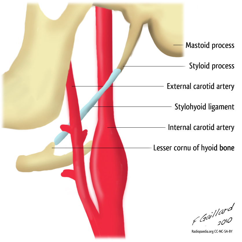 Styloid apparatus | Image | Radiopaedia.