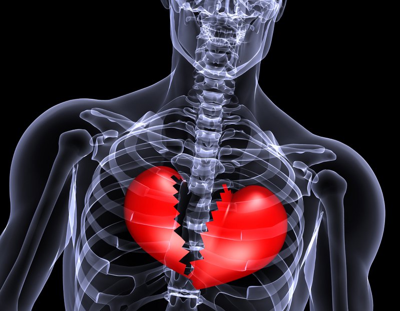 Is Broken Heart Syndrome Real? - MOGUL