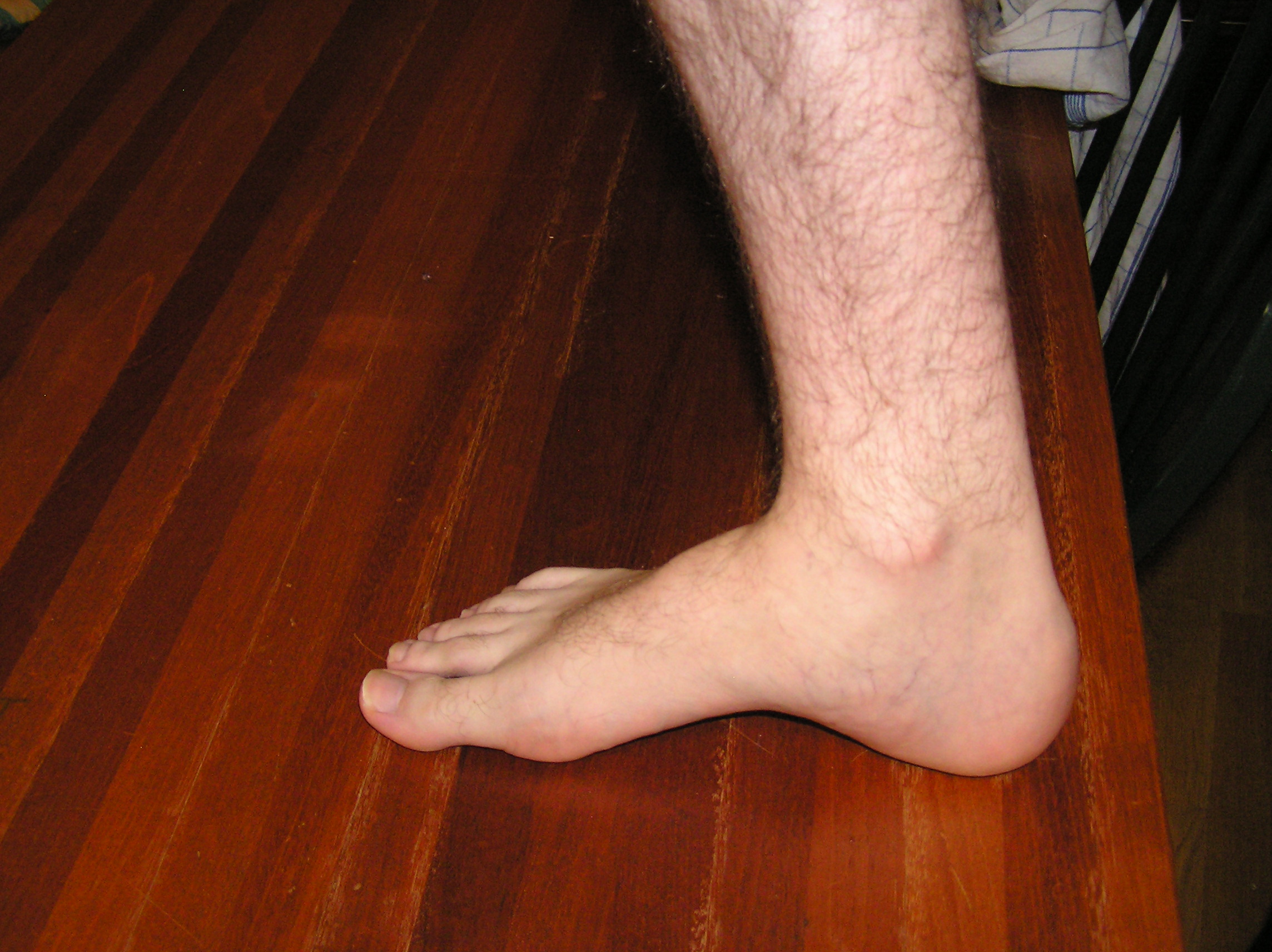 foot photo reference