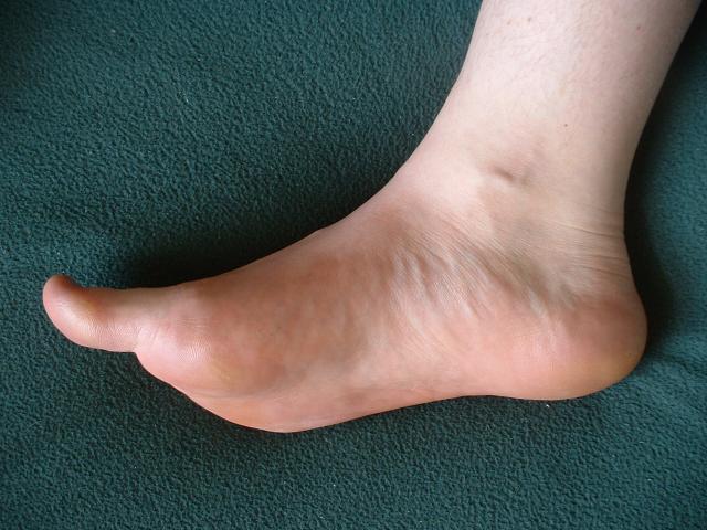 File:Foot-inside.jpg - Wikimedia Commons