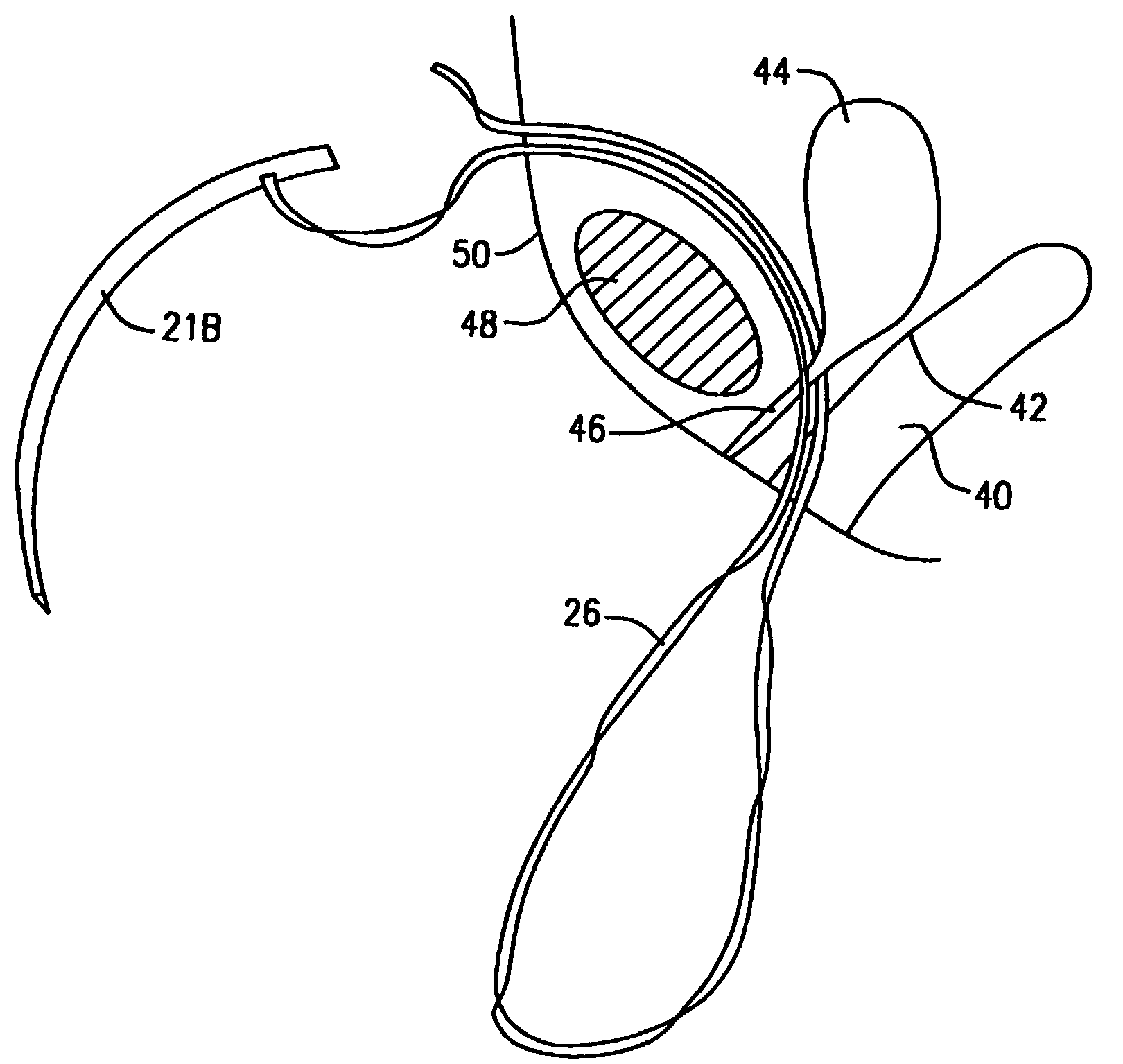 Patent US7658743 - Surgical instrument and method for treating ...
