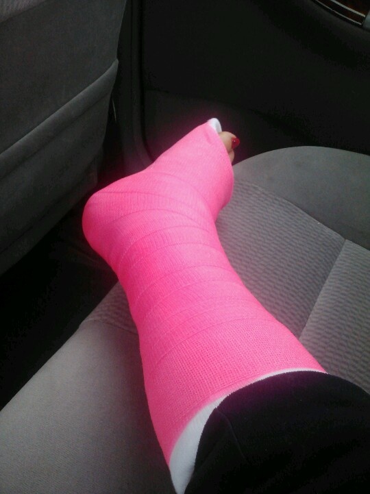 My first cast. The bright pink is pretty! | My broken leg. | Pinterest