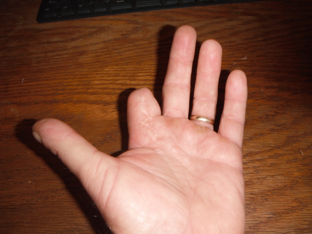 One finger braking - index or middle finger?- Mtbr.com