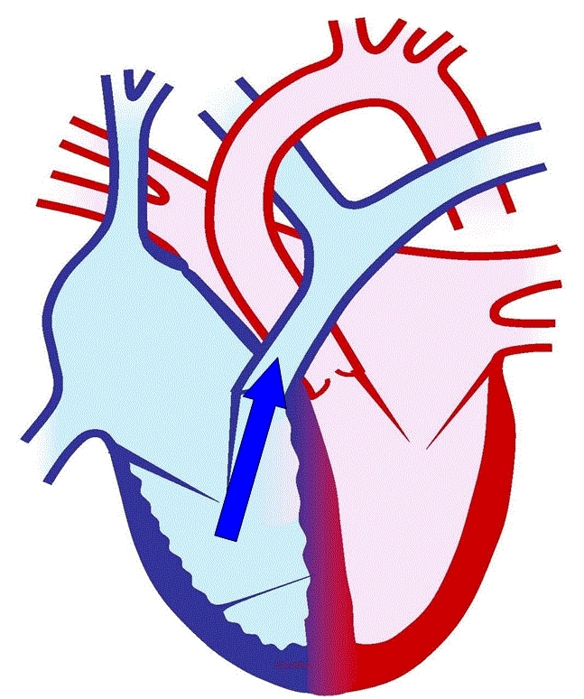 How the Heart Works | Little Big Heart Trust