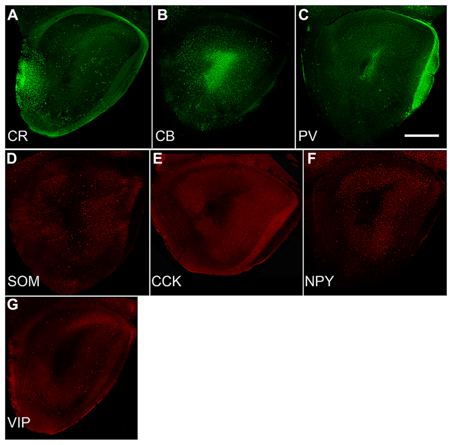 Frontiers | The mouse olfactory peduncle. 3. Development of ...