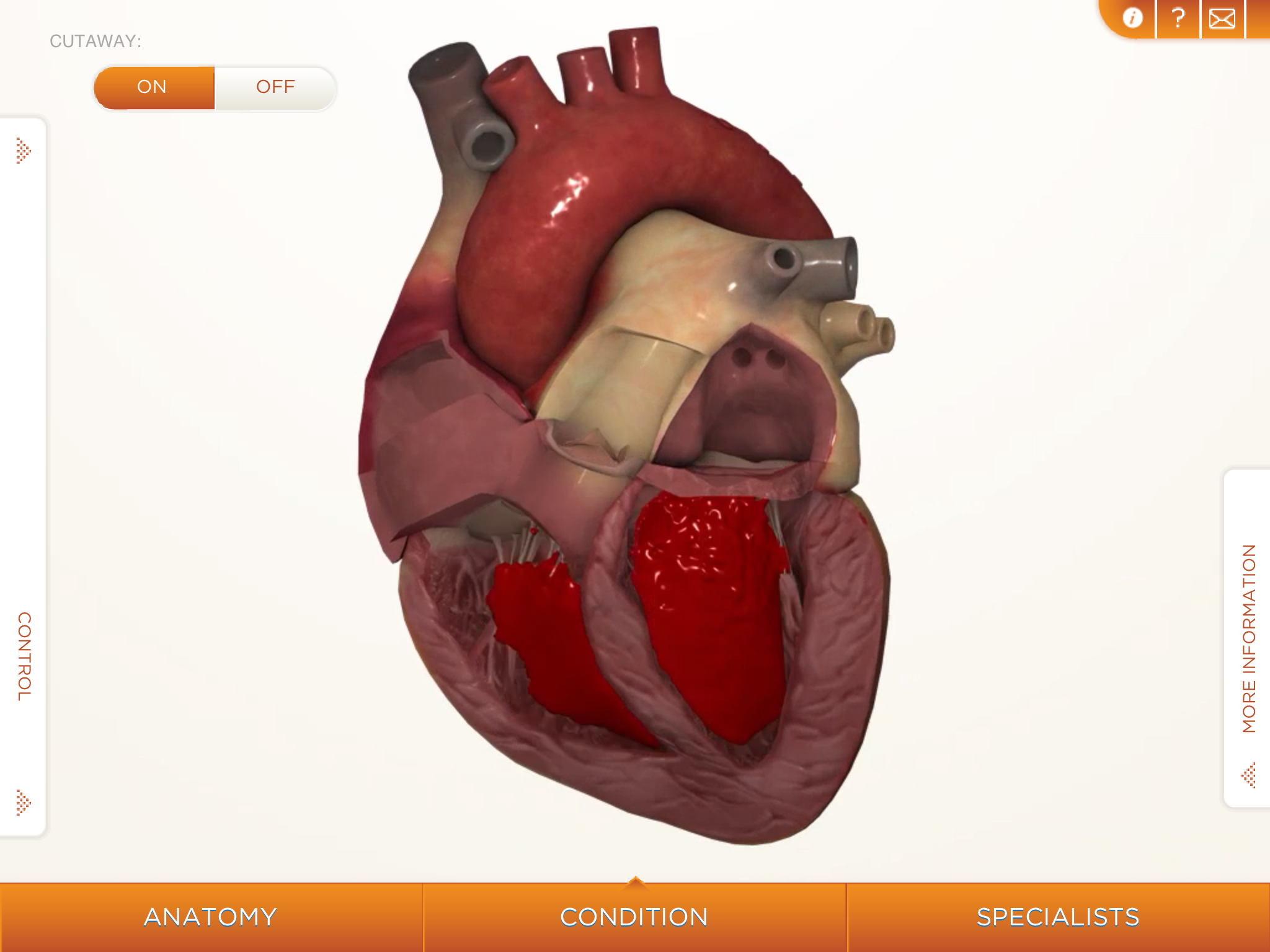 heart - Orca Health Decide | Orca Health Decide