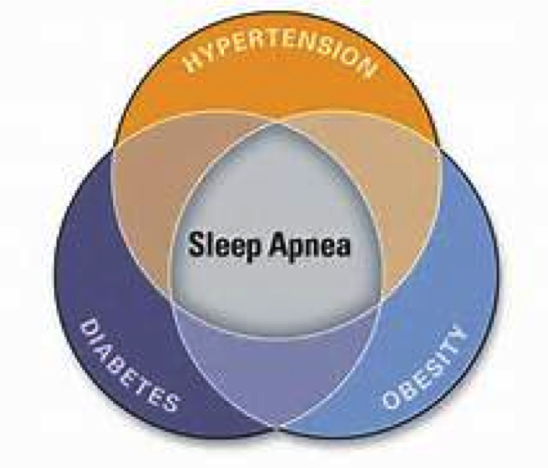 What is Obstructive Sleep Apnea and Why is the Dentist the Best ...