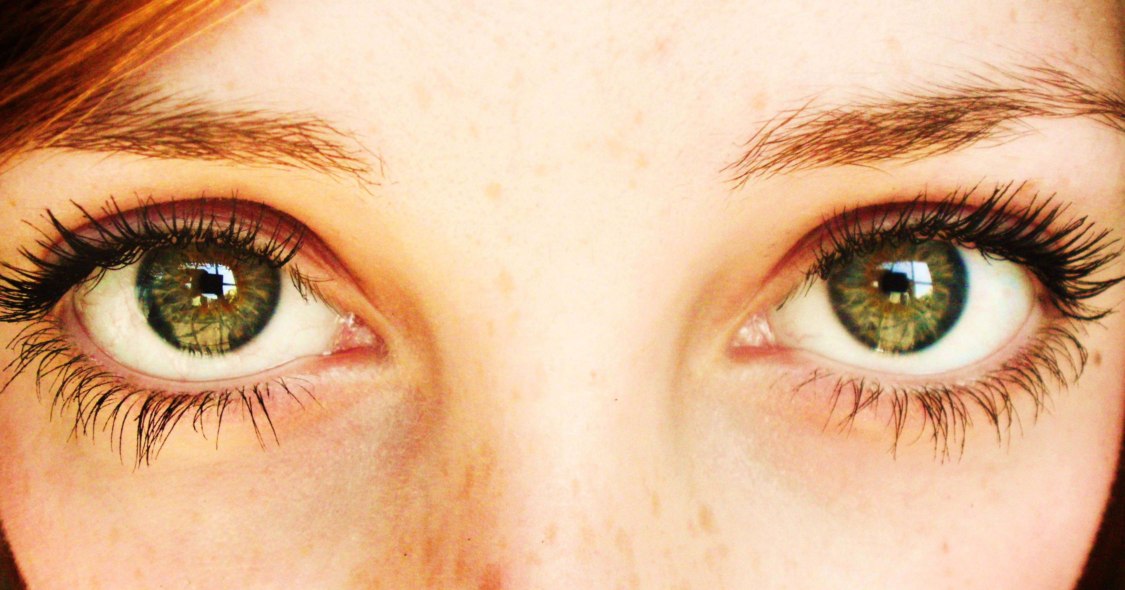 How Your Eyes Can Reveal Serious Health Problems | BodyRock