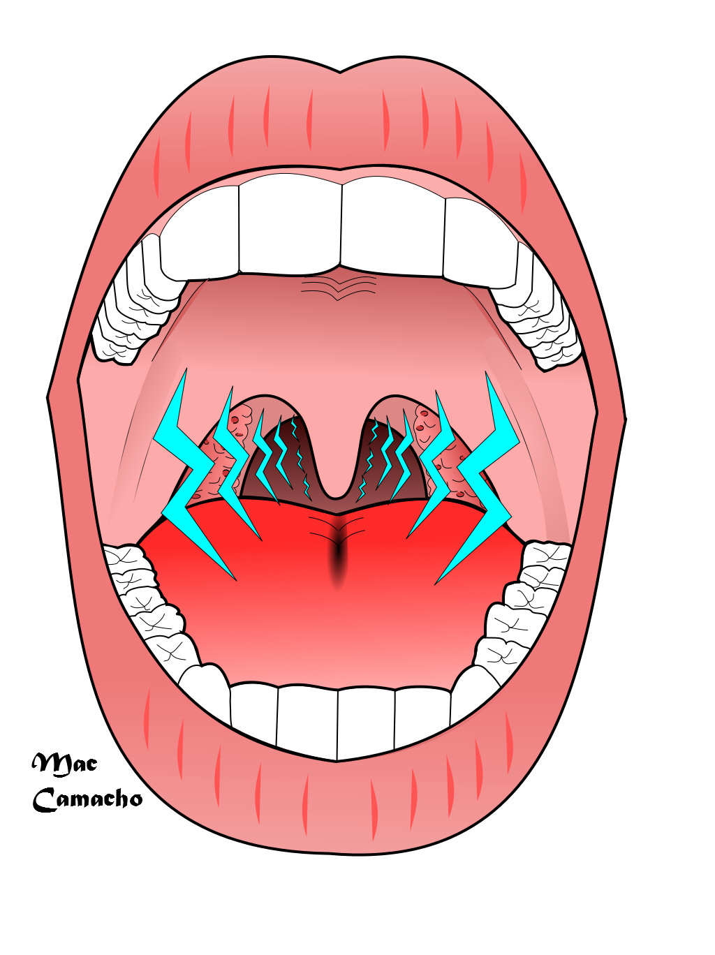 Snoring - Wikipedia, the free encyclopedia