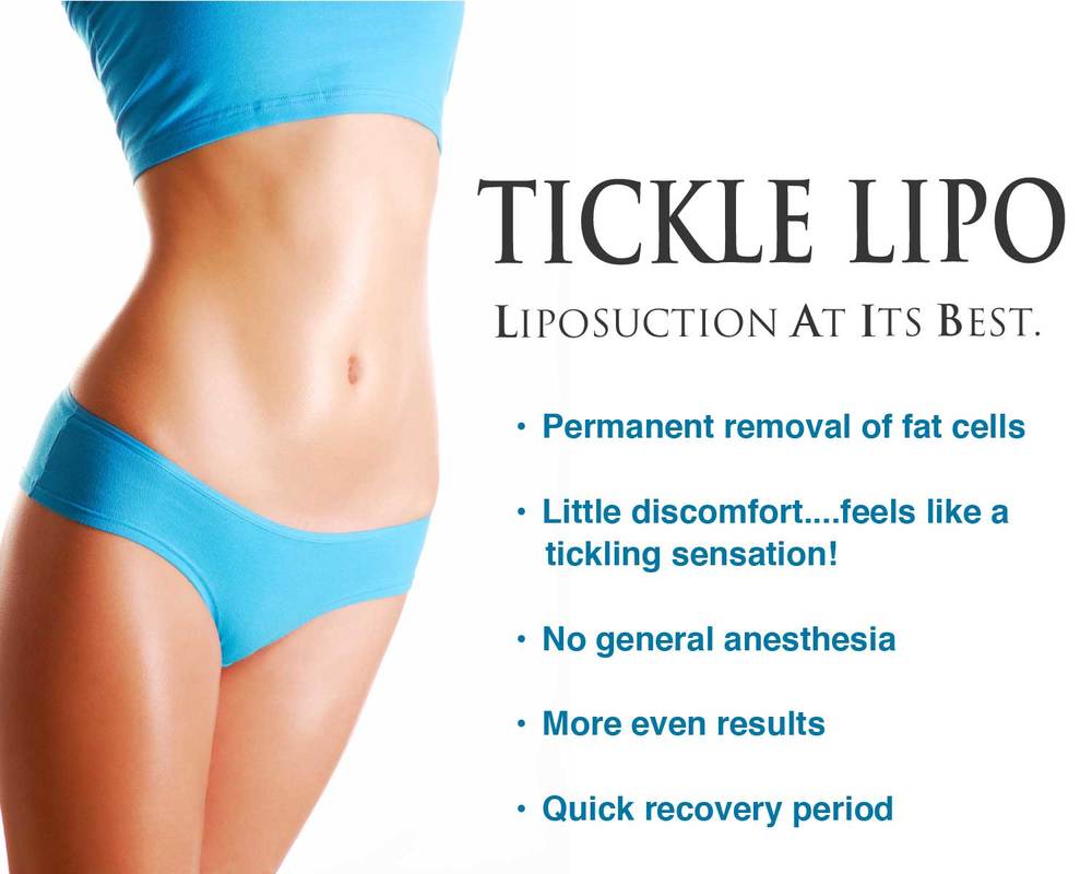 TICKLE LIPO - Liposuction in Charlotte, NC - Evolve Medical Associates