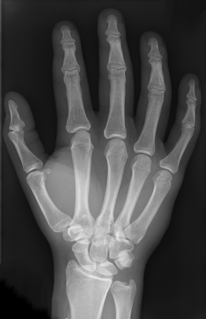 Hand - Wikipedia, the free encyclopedia