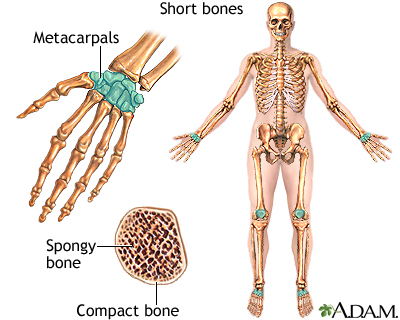Short bones: MedlinePlus Medical Encyclopedia Image