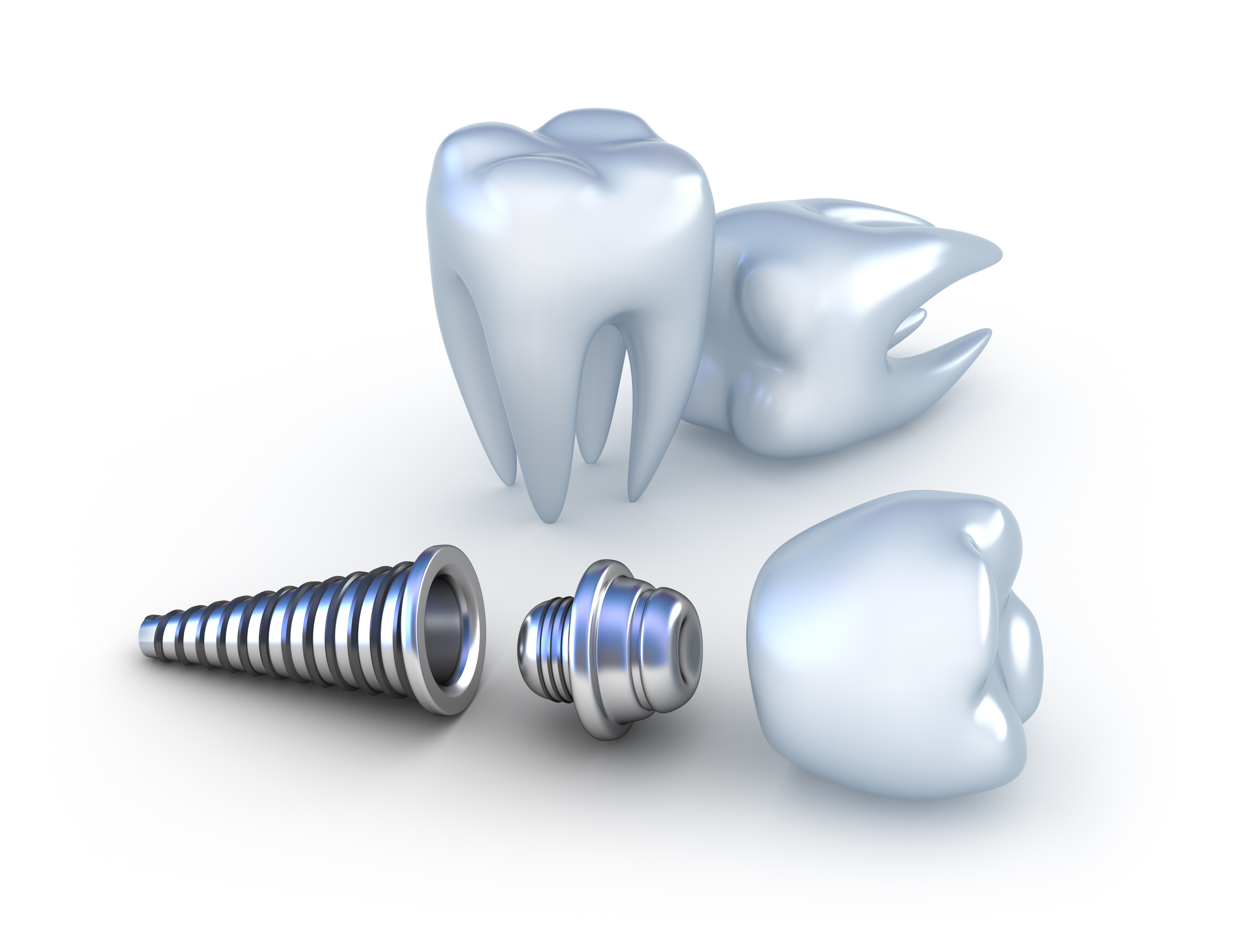Dental Implants | Dental Associates of Aurora