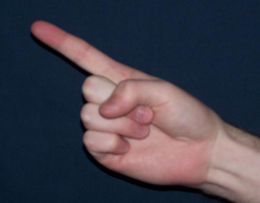 File:Index finger.JPG - Wikipedia, the free encyclopedia