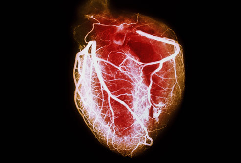 WebMD Heart Disease Health Center – Information About Heart Disease